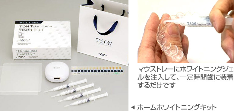 ホームホワイトニングキット